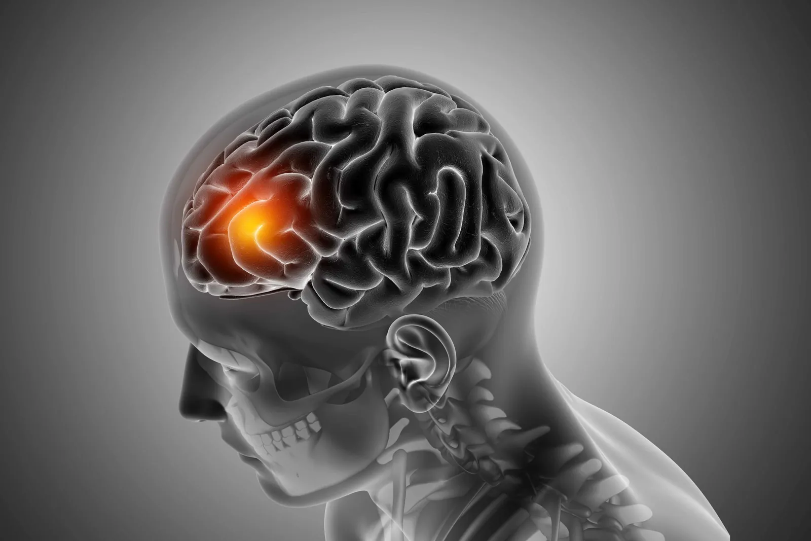 Confabulaciones: Cuando la ficción se hace real 8 dano cerebral confabulaciones | Neurita