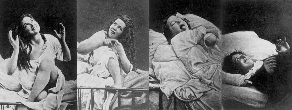 ¿Qué es la histeria? 7 hysteria | Neurita