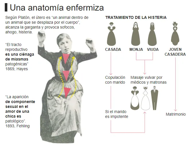 ¿Qué es la histeria? 8 tatamiento histeria | Neurita